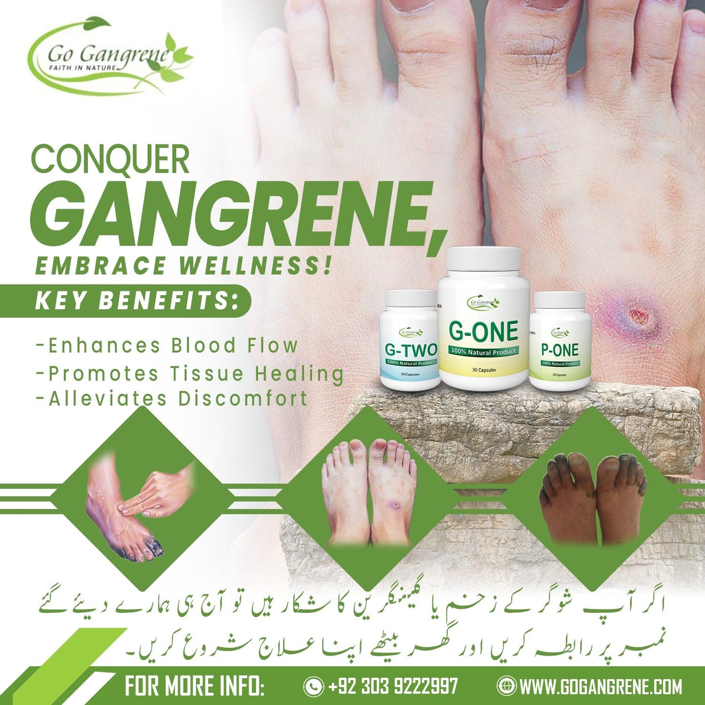 گینگرین یا شوگر کے زخموں کے لئے