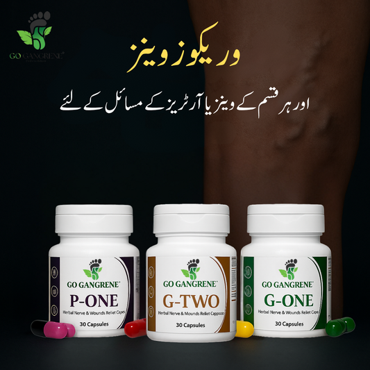 Varicose veins (ویریکوز وینز)